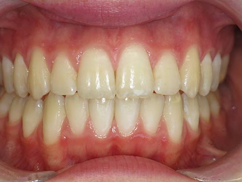 EXPANSION 3 FINAL RESULT