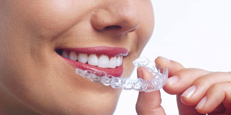 800x400 aligner